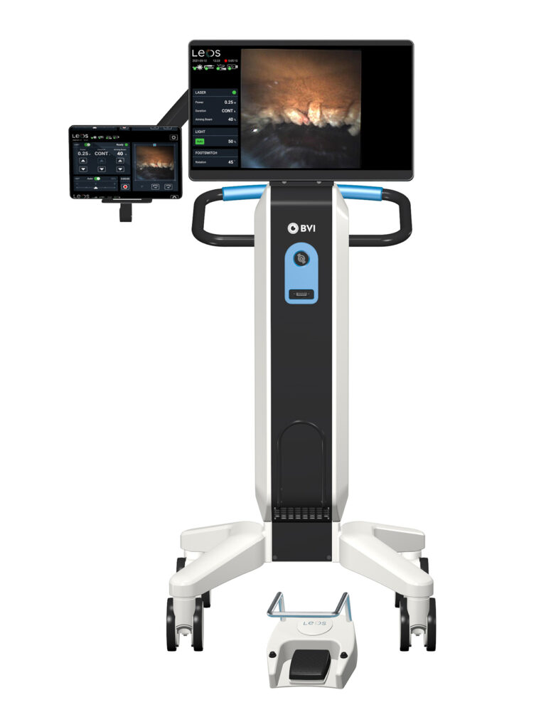 A Long-Awaited Upgrade for Endoscopic Cyclophotocoagulation 5 BVI p21 leos fig1